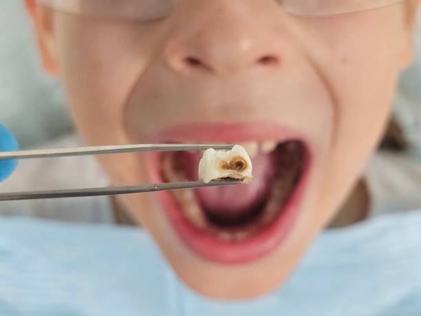 Best Weekend Emergency Dentist in Pittsville, MD